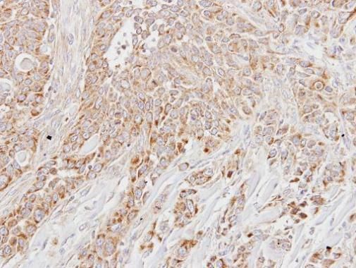 LETM1 Rabbit Polyclonal Antibody