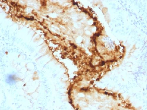 Lewis Y (Tumor Marker) Antibody