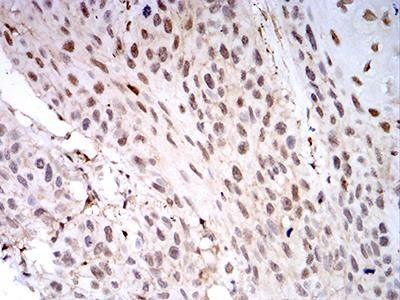 LGALS1 Antibody
