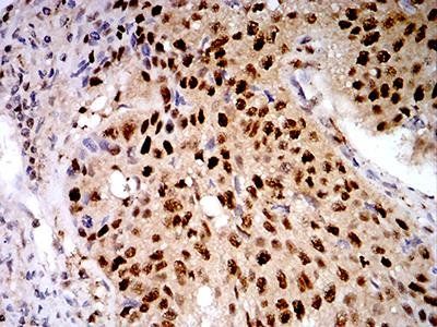 LGALS1 Antibody