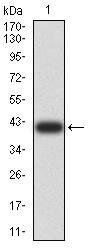 LGALS1 Antibody