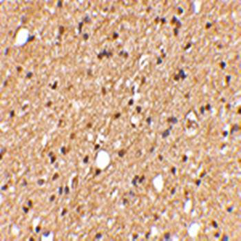 LGI2 Antibody