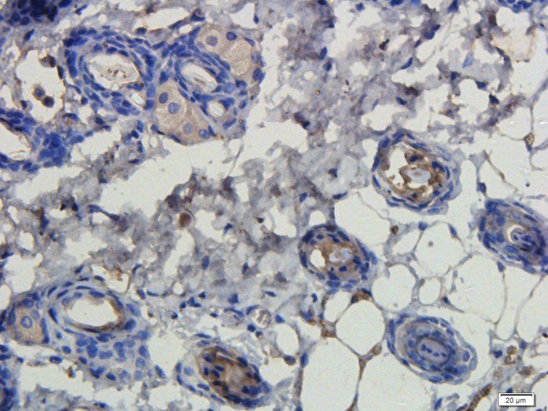 LHCGR Rabbit Polyclonal Antibody