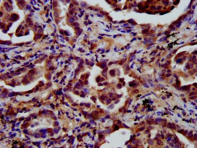 LIFR Antibody