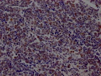 LIG1 Antibody