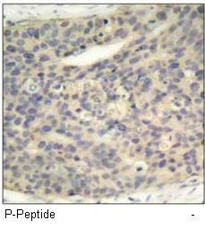 LIMK2 (Phospho-Thr505) Antibody
