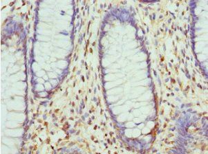 LIMS1 Antibody