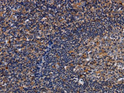 LIMS1 Antibody