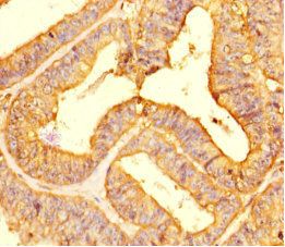 LIMS3 Antibody
