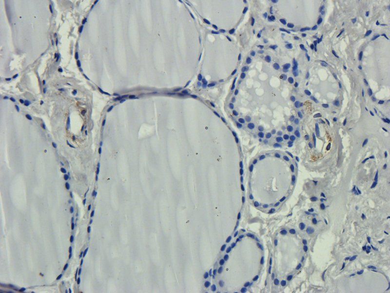 LIPG Rabbit Polyclonal Antibody