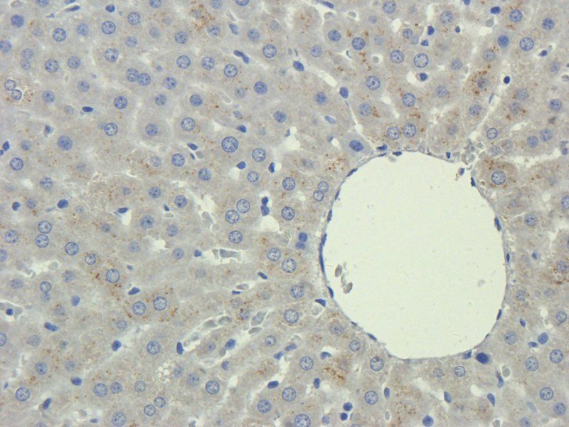 LIPG Rabbit Polyclonal Antibody