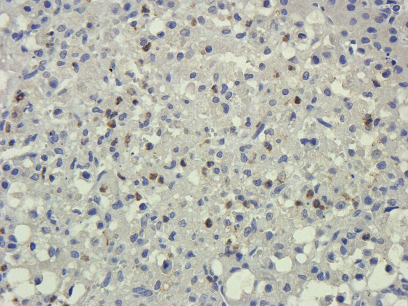 LIPG Rabbit Polyclonal Antibody