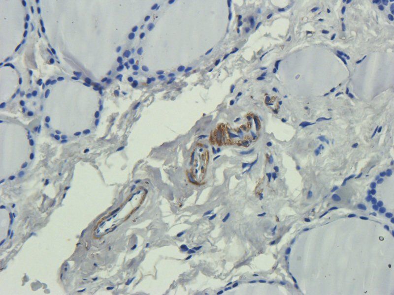 LIPG Rabbit Polyclonal Antibody