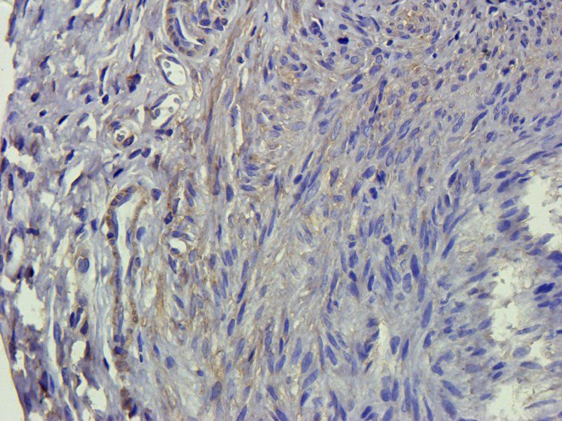 LIPG Rabbit Polyclonal Antibody