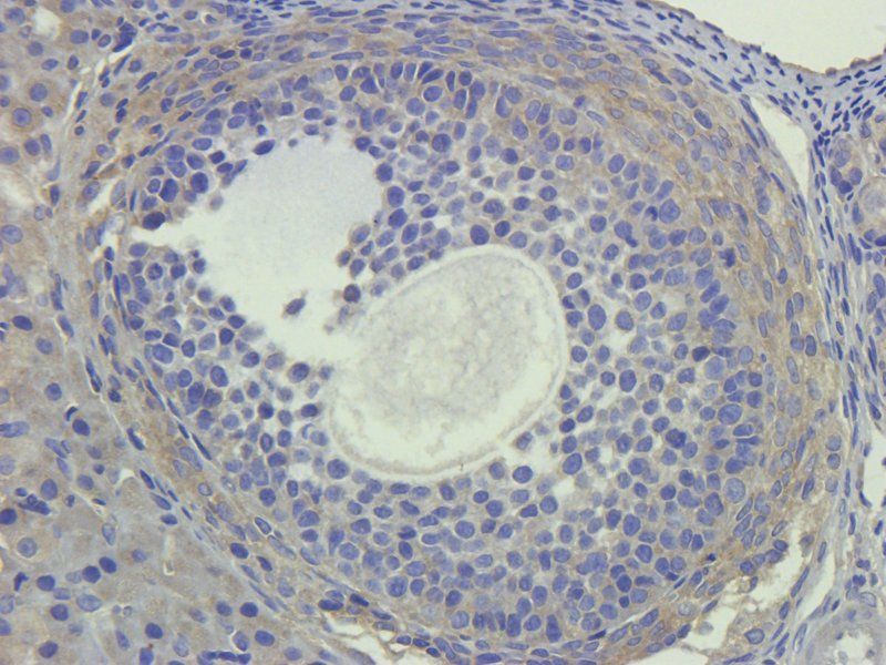 LIPG Rabbit Polyclonal Antibody