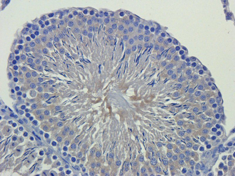LIPG Rabbit Polyclonal Antibody