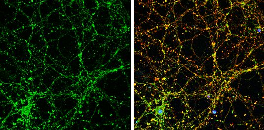 Liprin alpha 1 Rabbit Polyclonal Antibody