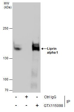 Liprin alpha 1 Rabbit Polyclonal Antibody