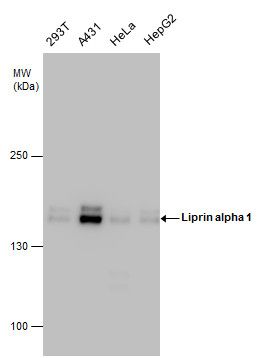 Liprin alpha 1 Rabbit Polyclonal Antibody