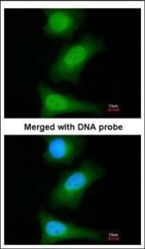 Livin Rabbit Polyclonal Antibody
