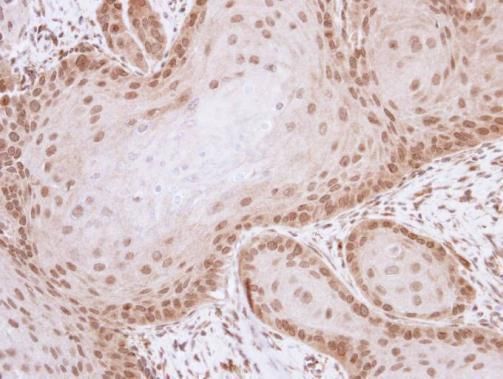 Livin Rabbit Polyclonal Antibody