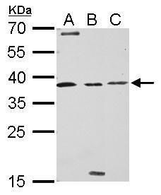 Livin Rabbit Polyclonal Antibody