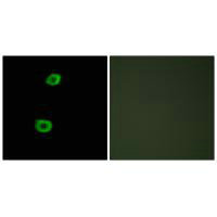 LMTK2 Antibody