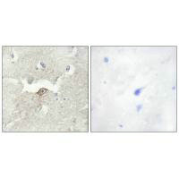 LMTK2 Antibody
