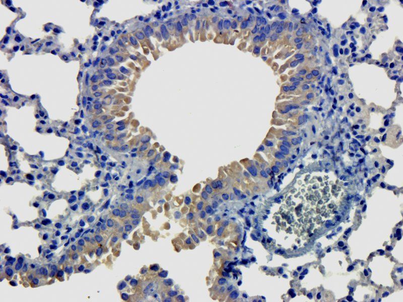 LOX-1 Rabbit Polyclonal Antibody