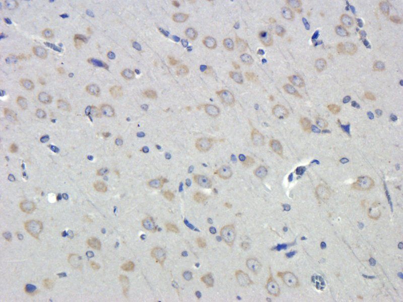 LOX-1 Rabbit Polyclonal Antibody