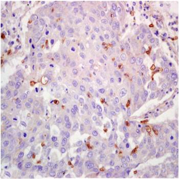 LOX-1 Rabbit Polyclonal Antibody