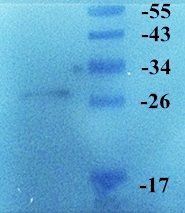 LOX-1 Rabbit Polyclonal Antibody