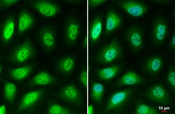 LOXL2 Rabbit Polyclonal Antibody