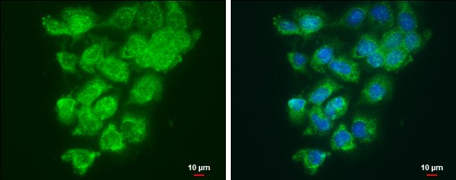 LOXL2 Rabbit Polyclonal Antibody