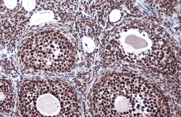 LOXL2 Rabbit Polyclonal Antibody