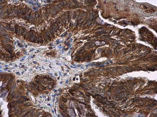 LOXL2 Rabbit Polyclonal Antibody