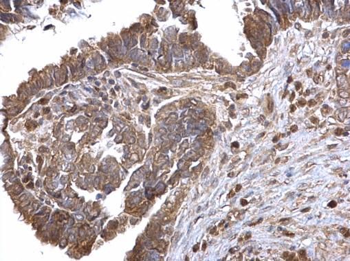 LOXL2 Rabbit Polyclonal Antibody