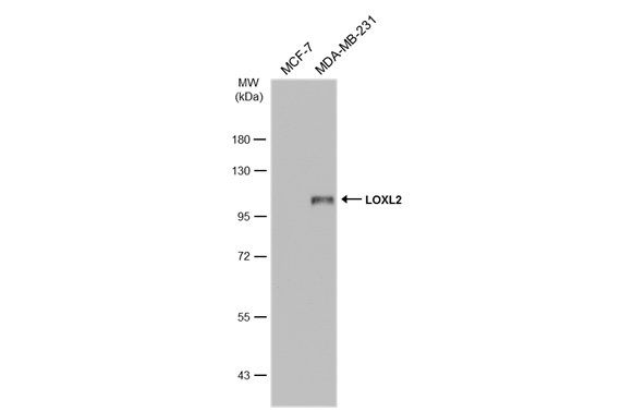 LOXL2 Rabbit Polyclonal Antibody