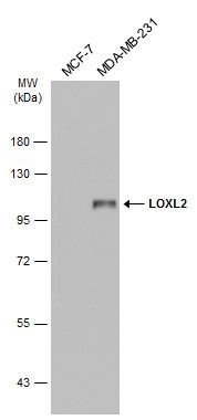 LOXL2 Rabbit Polyclonal Antibody