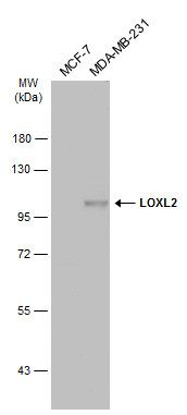 LOXL2 Rabbit Polyclonal Antibody