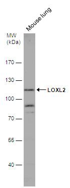 LOXL2 Rabbit Polyclonal Antibody