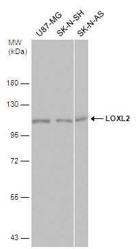 LOXL2 Rabbit Polyclonal Antibody