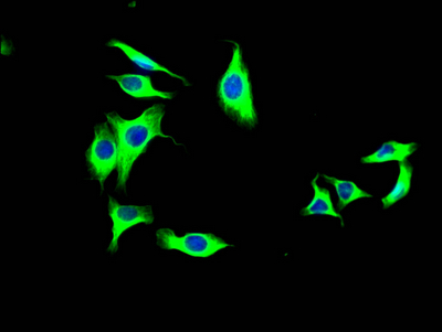 LOXL2 Antibody