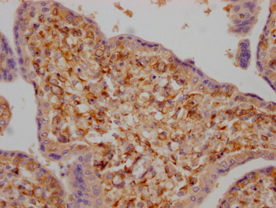 LOXL2 Antibody