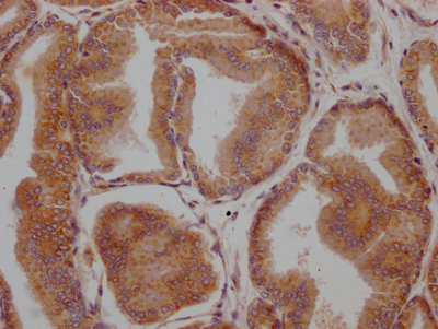 LOXL2 Antibody
