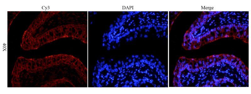 LOXL2 Rabbit Polyclonal Antibody