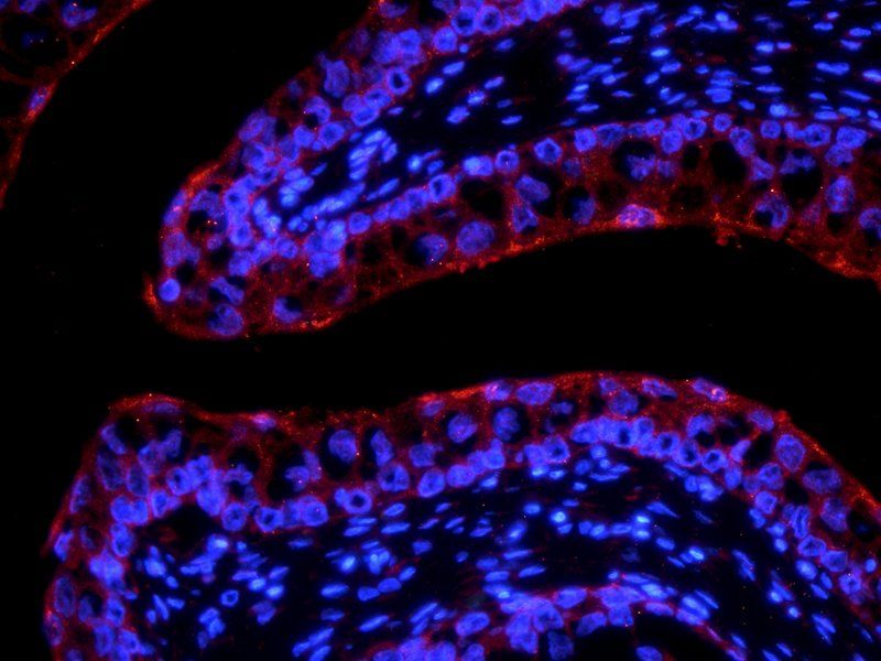 LOXL2 Rabbit Polyclonal Antibody