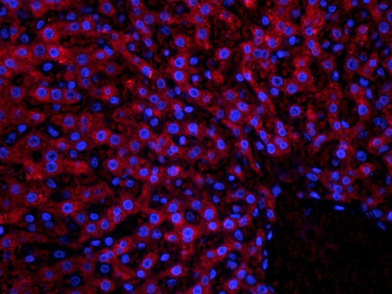 LOXL2 Rabbit Polyclonal Antibody