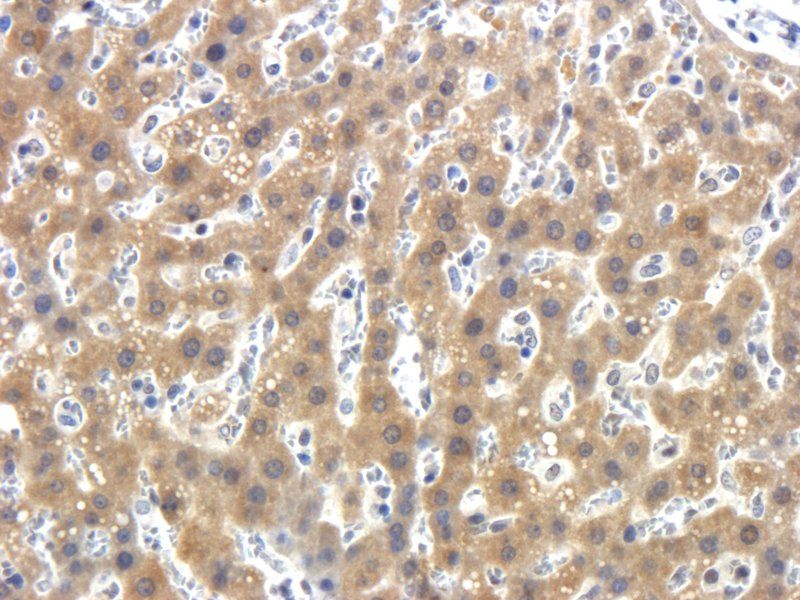 LOXL2 Rabbit Polyclonal Antibody