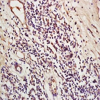 LOXL2 Rabbit Polyclonal Antibody